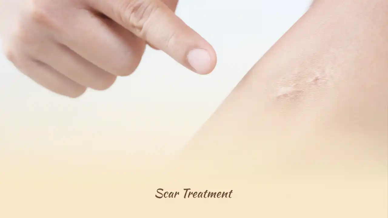 Scar Treatment Cost in Istanbul